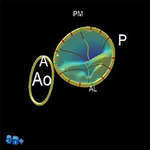 УЛЬТРАЗВУКОВОЙ АППАРАТ CX50 image