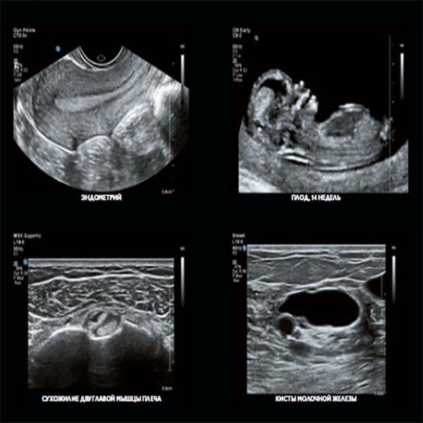 УЛЬТРАЗВУКОВОЙ АППАРАТ EPIQ7 image