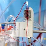 СИСТЕМА МОНИТОРИНГА ПАРАМЕТРОВ КРОВИ (МОНИТОР CDI 500) image