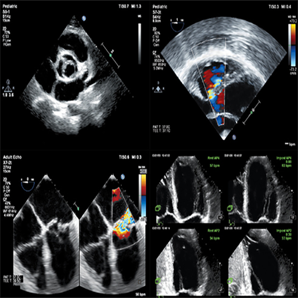 УЛЬТРАЗВУКОВОЙ АППАРАТ EPIQ5 image