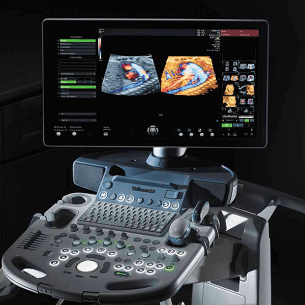 УЗИ АППАРАТ VOLUSON S8 (ВЫСОКИЙ ПОТОК ПАЦИЕНТОВ) image