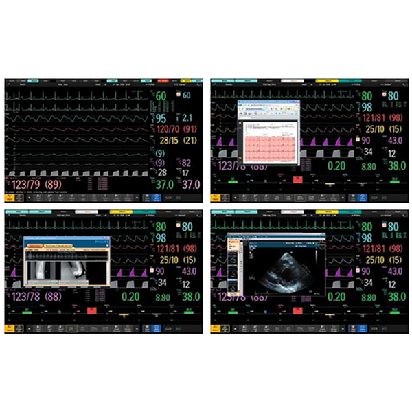 МОНИТОР ПАЦИЕНТА PHILIPS INTELLIVUE 850 image