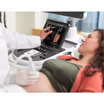 УЛЬТРАЗВУКОВАЯ СИСТЕМА ПРЕМИУМ КЛАССА PHILIPS EPIQ ELITE image