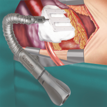 СТАБИЛИЗАТОР МИОКАРДА HERCULES (ДЛЯ ОПЕРАЦИЙ НА РАБОТАЮЩЕМ СЕРДЦЕ)