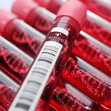 ГЕМАТОЛОГИЯ