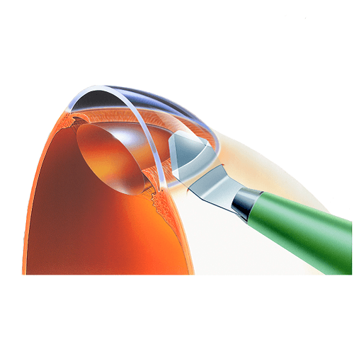 Изображение СКАЛЬПЕЛЬ-РАСШИРИТЕЛЬ