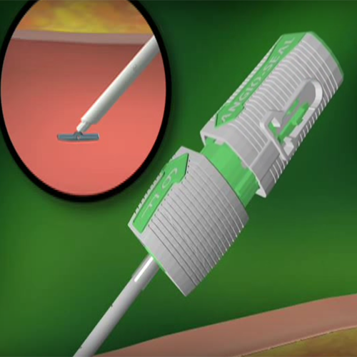 Изображение АНГИОСИЛ УСТРОЙСТВО ДЛЯ ЗАКРЫТИЯ ПУНКЦИИ (ANGIO-SEAL VIP)