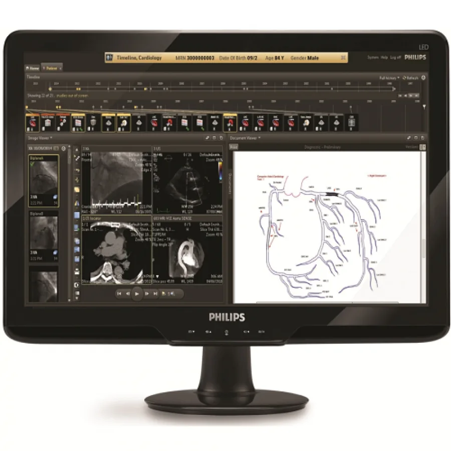 Изображение PHILIPS INTELLSPASE CARDIOVASCULAR