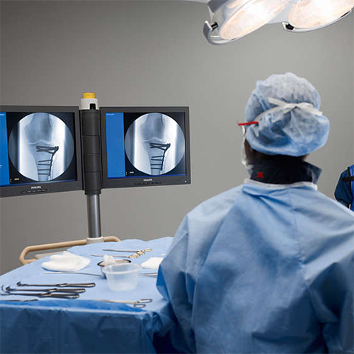 Изображение BV PULSERA ПЕРЕДВИЖНОЙ РЕНТГЕНХИРУРГИЧЕСКИЙ АППАРАТ