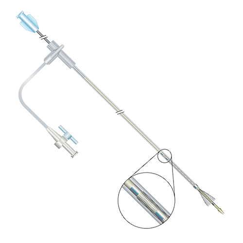 Изображение САМОРАСШИРЯЮЩИЙСЯ СТЕНТ WALLSTENT-UNI ДЛЯ ПОДВЗДОШНОЙ ВЕНЫ