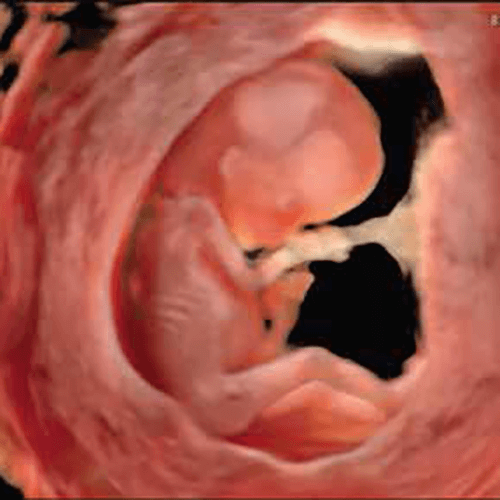 Изображение УЗИ АППАРАТ (ЭКСПЕРТНЫЙ УРОВЕНЬ ЖЕНСКОГО ЗДОРОВЬЯ) VOLUSON E10