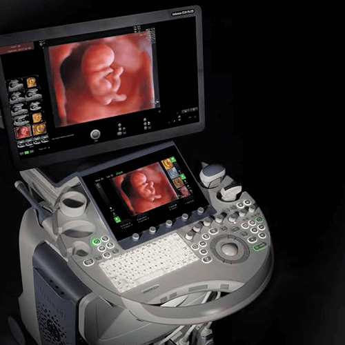 Изображение УЗИ АППАРАТ (ЭКСПЕРТНЫЙ УРОВЕНЬ ЖЕНСКОГО ЗДОРОВЬЯ) VOLUSON E10