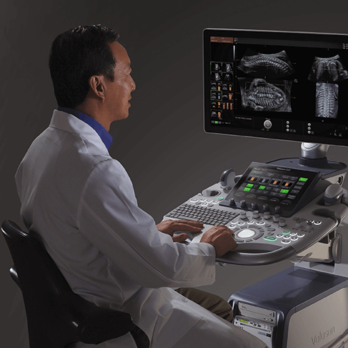 Изображение УЗИ АППАРАТ VOLUSON S10 (УНИВЕРСАЛЬНАЯ СИСТЕМА ДЛЯ ЧАСТНОЙ КЛИНИКИ)
