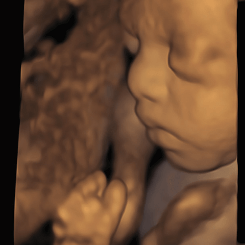 Изображение УЗИ АППАРАТ VOLUSON S10 (УНИВЕРСАЛЬНАЯ СИСТЕМА ДЛЯ ЧАСТНОЙ КЛИНИКИ)