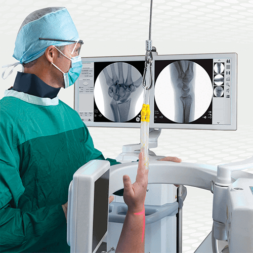 Изображение РЕНТГЕНОВСКАЯ С-ДУГА ДЛЯ КОНЕЧНОСТЕЙ OEC ELITE MINIVIEW