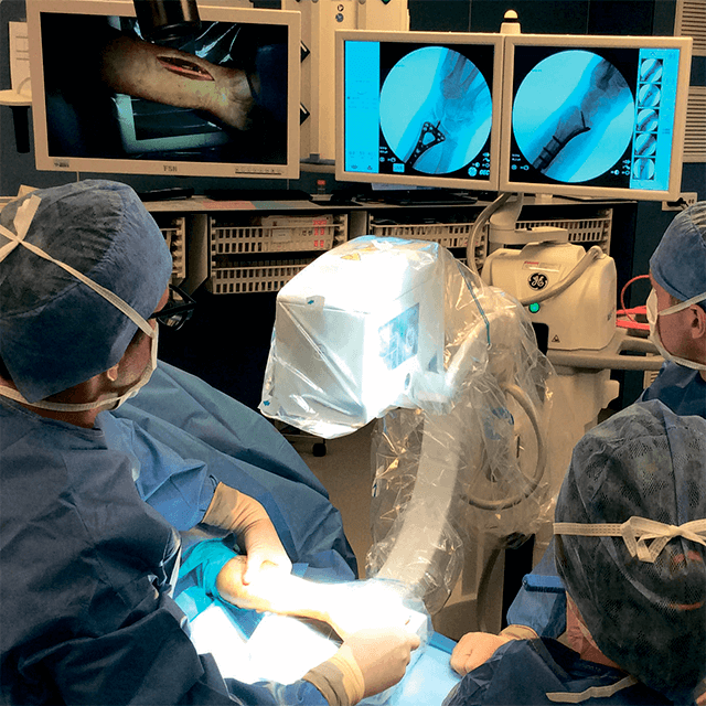 Изображение РЕНТГЕНОВСКАЯ С-ДУГА ДЛЯ КОНЕЧНОСТЕЙ OEC ELITE MINIVIEW