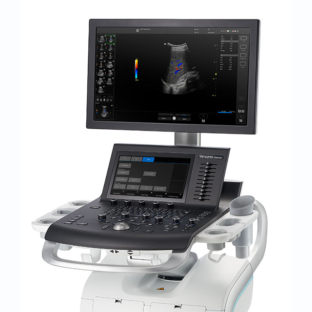 Изображение УЗИ АППАРАТ (ПЕРВИЧНАЯ ДИАГНОСТИКА) VERSANA ESSENTIAL