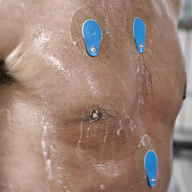 Изображение ЭКГ ЭЛЕКТРОД ДЛЯ ДЛИТЕЛЬНОГО МОНИТОРИРОВАНИЯ BLUESENSOR VL