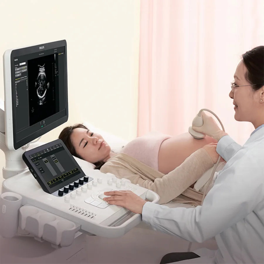 Изображение УЛЬТРАЗВУКОВОЙ АППАРАТ PHILIPS 3300 (ДЛЯ АКУШЕРСТВА И ГИНЕКОЛОГИИ)
