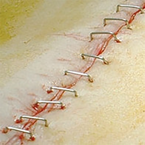 Изображение КОЖНЫЙ СТЕПЛЕР APPOSE