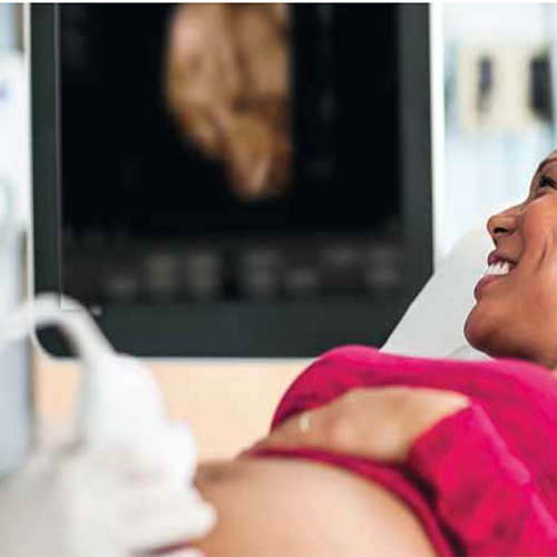 Изображение УЛЬТРАЗВУКОВОЙ АППАРАТ CLEARVUE 650