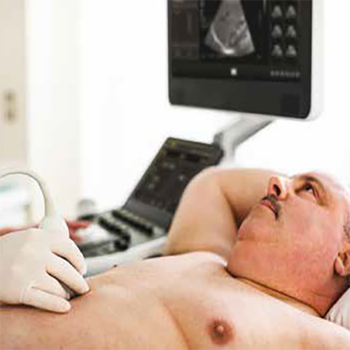 Изображение УЛЬТРАЗВУКОВОЙ АППАРАТ AFFINITY 70