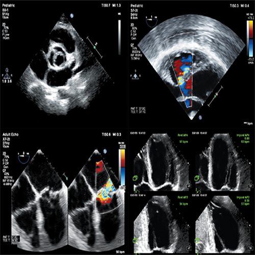 Изображение УЛЬТРАЗВУКОВОЙ АППАРАТ AFFINITY 70