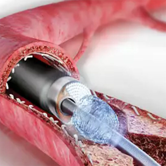 Изображение ЭКСИМЕРНАЯ ЛАЗЕРНАЯ СИСТЕМА CVX-300 EXCIMER