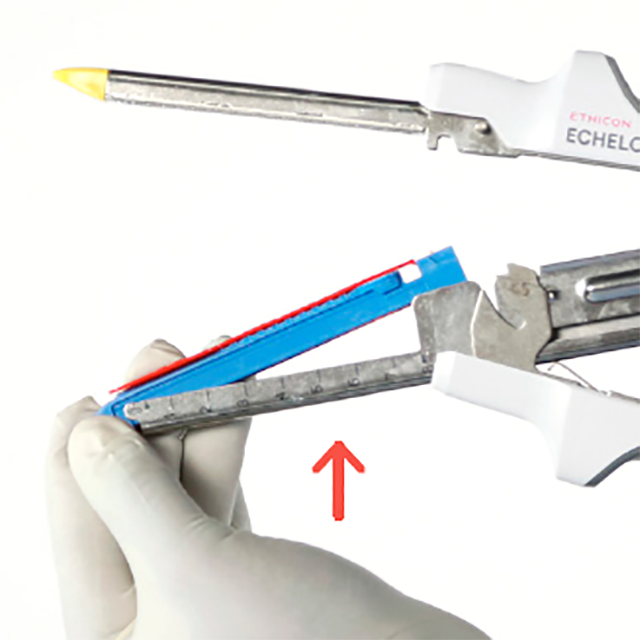 Изображение КАССТЕЫ ДЛЯ ЛИНЕЙНОГО СШИВАЮЩЕГО-РЕЖУЩЕГО АППАРАТА ECHELON LINEAR