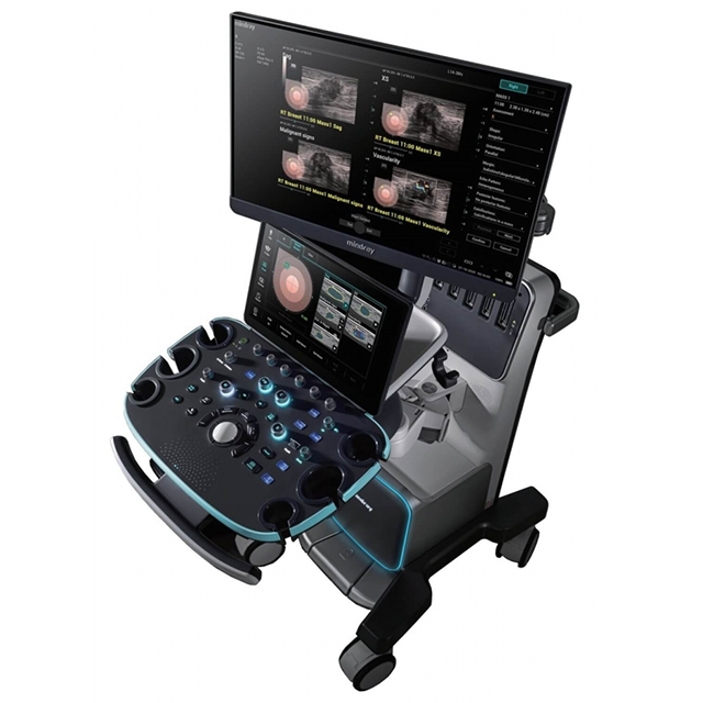 Изображение УЗИ АППАРАТ VIVID S70 (КОМПАКТНАЯ СИСТЕМА ЭКСПЕРТНОГО КЛАССА)