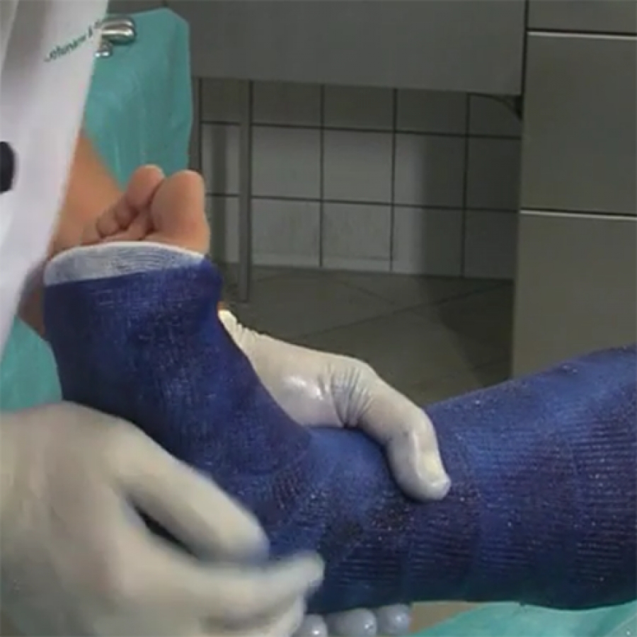 ПОВЯЗКА ИЗ ЦЕЛЛАКAСТА НА ГОЛЕНЬ