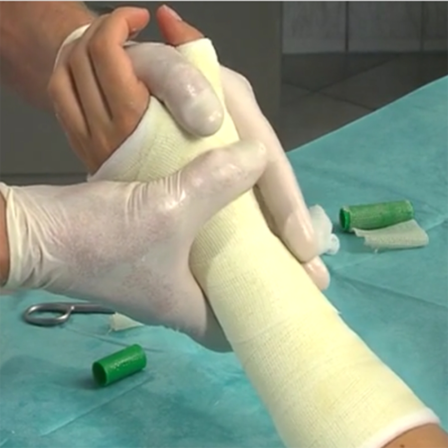 ПОВЯЗКА ИЗ ЦЕЛЛАКАСТА НА ПРЕДПЛЕЧЬЕ