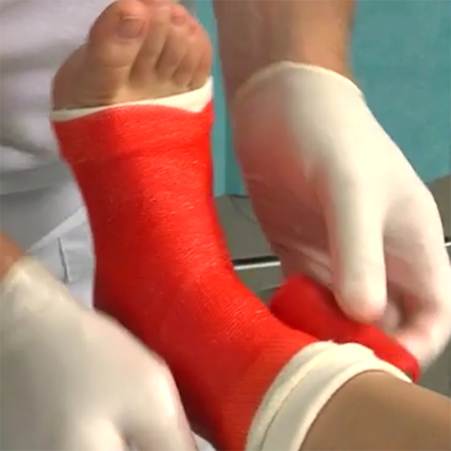 ЛОНГЕТА ИЗ ЦЕЛЛАКАСТА НА ГОЛЕНОСТОП