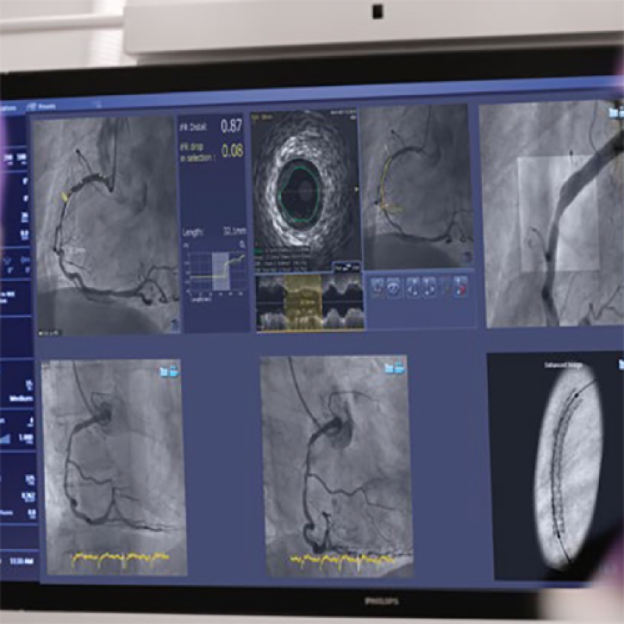 СИСТЕМА СИНХРОНИЗАЦИИ ИЗОБРАЖЕНИЯ SYNCVISION