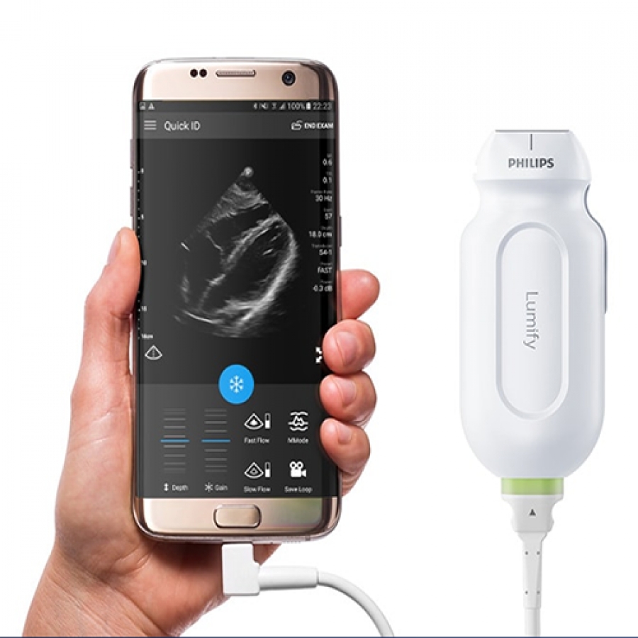 СИСТЕМА УЛЬТРАЗВУКОВАЯ ПОРТАТИВНАЯ LUMIFY