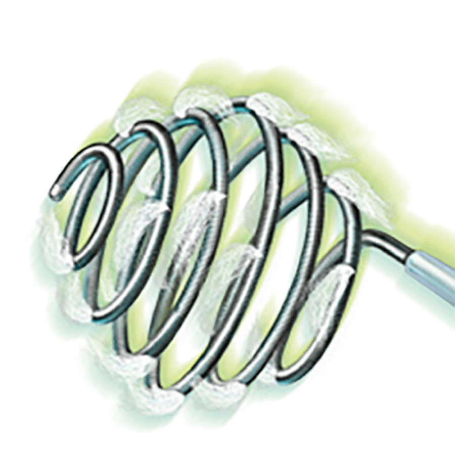 ТОЛКАЕМЫЕ СПИРАЛИ ДЛЯ ЭМБОЛИЗАЦИИ (РАЗЛИЧНЫЕ)