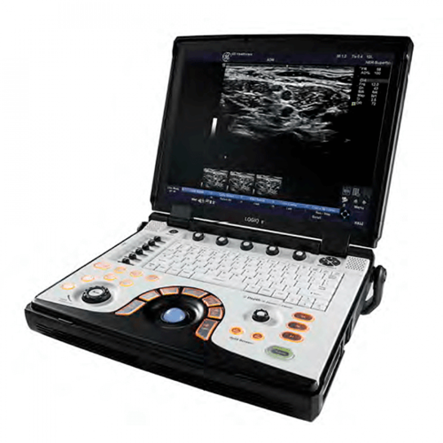 ПОРТАТИВНЫЙ УЗИ АППАРАТ ВЫСОКОГО КЛАССА LOGIQ e