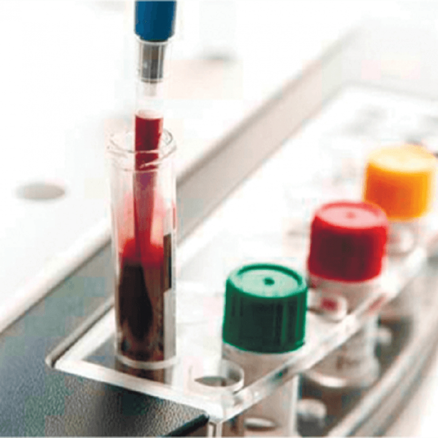 КОНТРОЛЬНЫЙ МАТЕРИАЛ ДЛЯ АНАЛИЗАТОРА ФУНКЦИИ ТРОМБОЦИТОВ MULTIPLATE ANALYZER (LIQUID CONTROL SET)