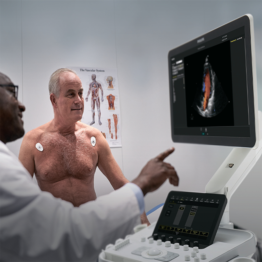 УЛЬТРАЗВУКОВОЙ АППАРАТ PHILIPS 3300 (КАРДИОЛОГИЧЕСКИЙ)