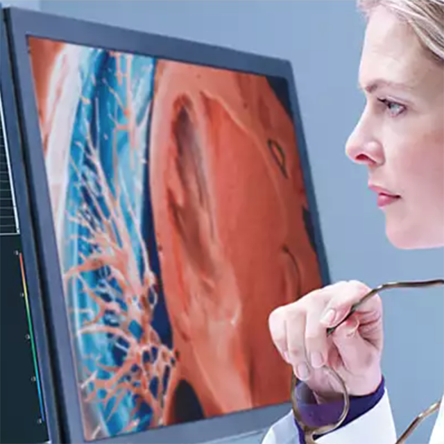 PHILIPS INTELLISPACE PORTAL 12